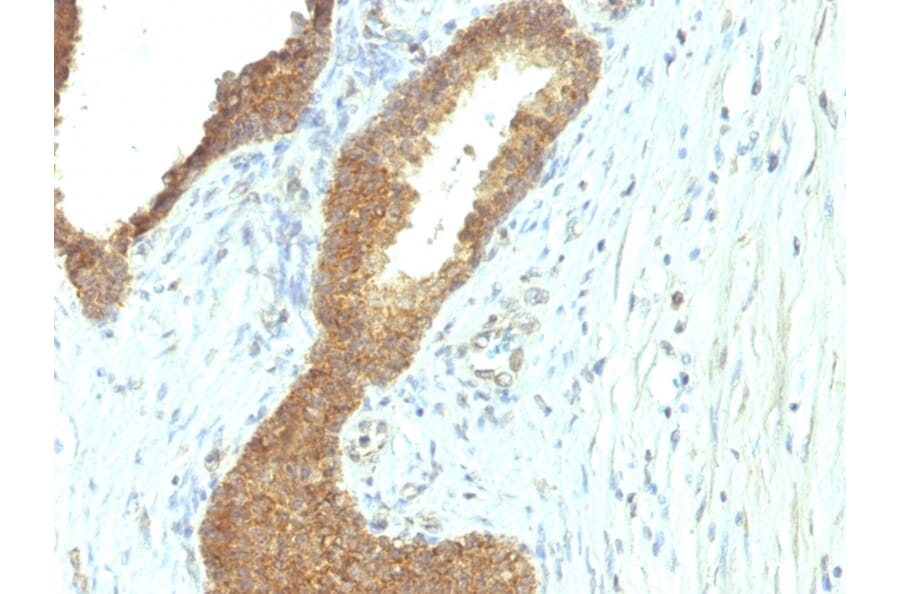 Immunohistochemistry - Anti-Alkaline Phosphatase, Tissue Non-Specific Antibody [ALPL/597] - BSA and Azide free (A251817) - Antibodies.com