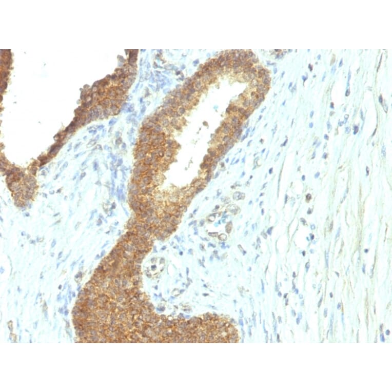 Immunohistochemistry - Anti-Alkaline Phosphatase, Tissue Non-Specific Antibody [ALPL/597] - BSA and Azide free (A251817) - Antibodies.com