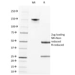 SDS-PAGE - Anti-Alkaline Phosphatase, Tissue Non-Specific Antibody [ALPL/597] - BSA and Azide free (A251818) - Antibodies.com