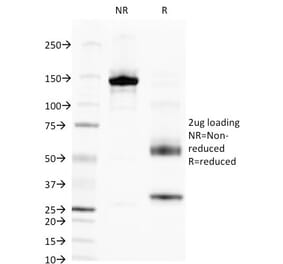 SDS-PAGE - Anti-Alkaline Phosphatase, Tissue Non-Specific Antibody [V17.1] - BSA and Azide free (A251819) - Antibodies.com