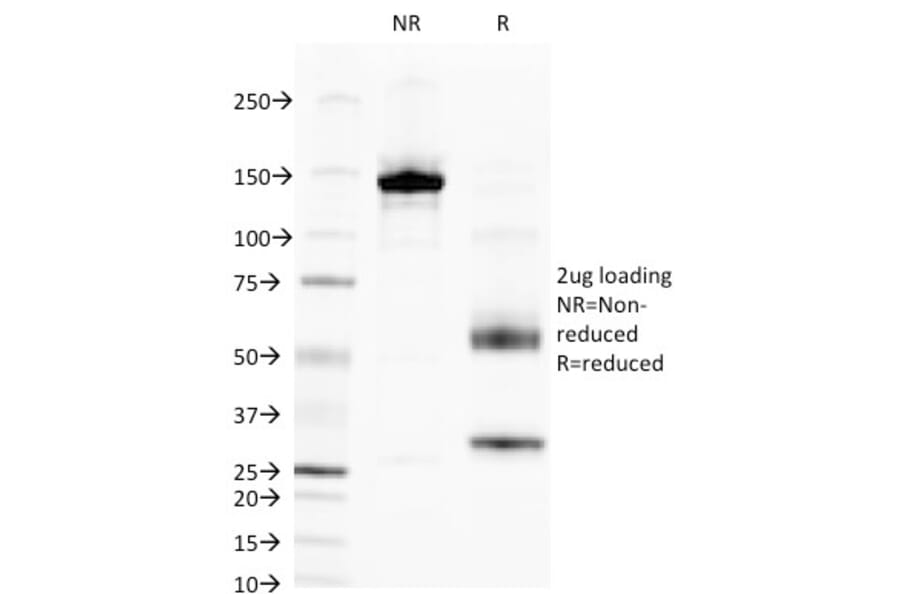 SDS-PAGE - Anti-Alkaline Phosphatase, Tissue Non-Specific Antibody [V17.1] - BSA and Azide free (A251819) - Antibodies.com