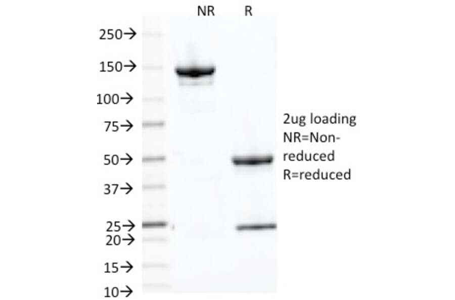 SDS-PAGE - Anti-Placental Alkaline Phosphatase Antibody [ALP/870] - BSA and Azide free (A251821) - Antibodies.com