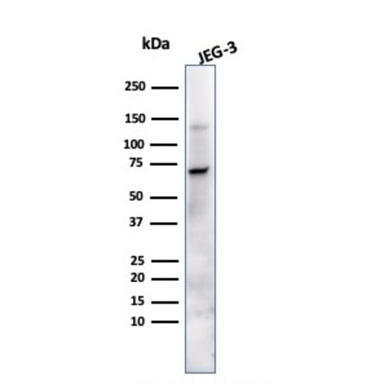 Western Blot - Anti-Placental Alkaline Phosphatase Antibody [ALP/870] - BSA and Azide free (A251821) - Antibodies.com