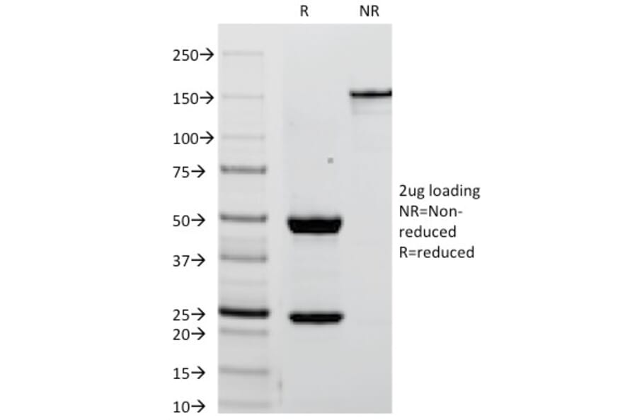 SDS-PAGE - Anti-Placental Alkaline Phosphatase Antibody [ALPP/238] - BSA and Azide free (A251822) - Antibodies.com
