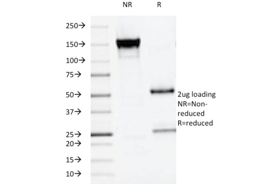 SDS-PAGE - Anti-Placental Alkaline Phosphatase Antibody [ALPP/516] - BSA and Azide free (A251823) - Antibodies.com