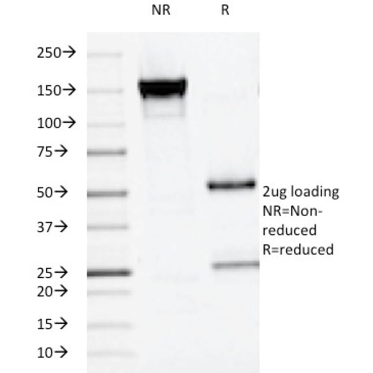 SDS-PAGE - Anti-Placental Alkaline Phosphatase Antibody [ALPP/516] - BSA and Azide free (A251823) - Antibodies.com