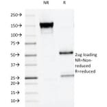 SDS-PAGE - Anti-Placental Alkaline Phosphatase Antibody [ALPP/516] - BSA and Azide free (A251823) - Antibodies.com