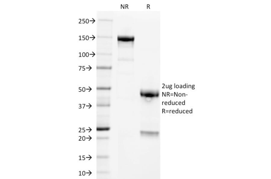 SDS-PAGE - Anti-Placental Alkaline Phosphatase Antibody [GM022] - BSA and Azide free (A251825) - Antibodies.com