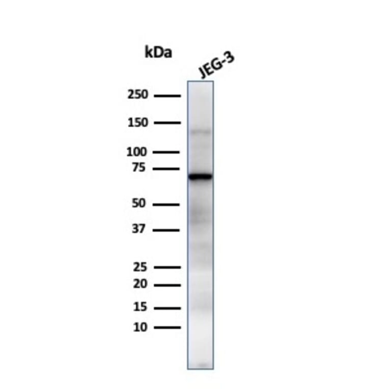 Western Blot - Anti-Placental Alkaline Phosphatase Antibody [GM022] - BSA and Azide free (A251825) - Antibodies.com