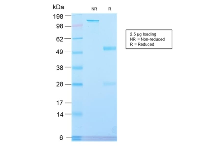 SDS-PAGE - Anti-Placental Alkaline Phosphatase Antibody [ALPP/2899R] - BSA and Azide free (A251827) - Antibodies.com