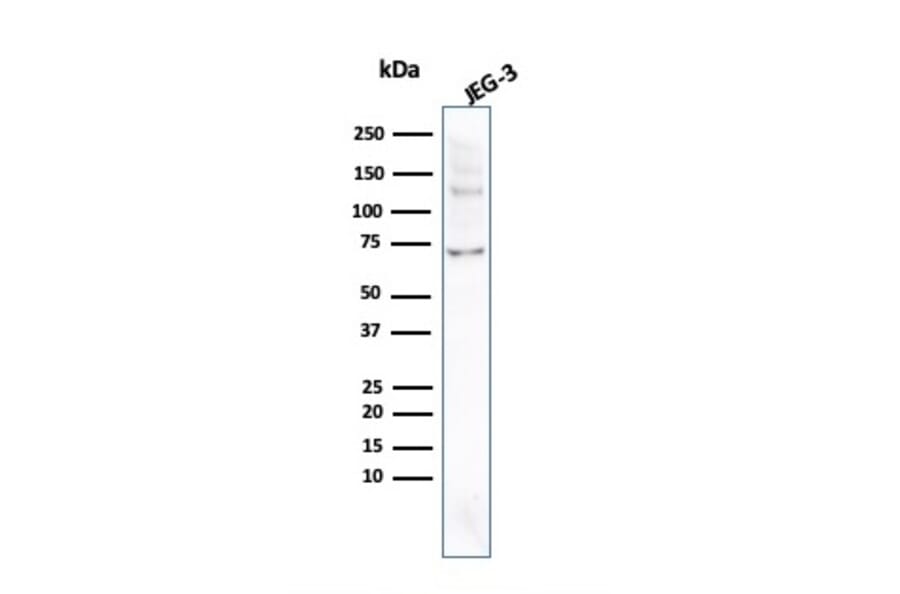 Western Blot - Anti-Placental Alkaline Phosphatase Antibody [ALPP/2899R] - BSA and Azide free (A251827) - Antibodies.com