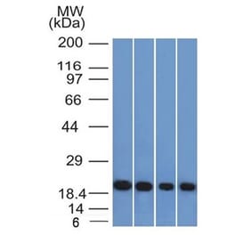 Western Blot - Anti-Ferritin Light Chain Antibody [FTL/1386] - BSA and Azide free (A251828) - Antibodies.com