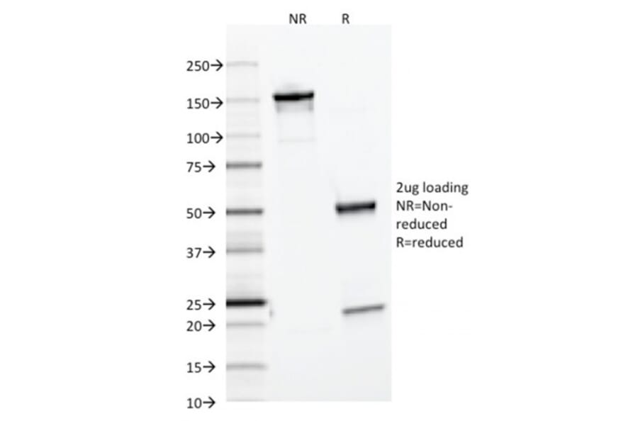 SDS-PAGE - Anti-Ferritin Light Chain Antibody [FTL/1386] - BSA and Azide free (A251828) - Antibodies.com