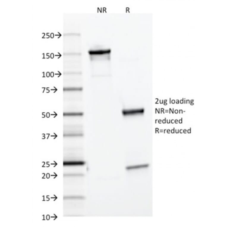 SDS-PAGE - Anti-Ferritin Light Chain Antibody [FTL/1386] - BSA and Azide free (A251828) - Antibodies.com