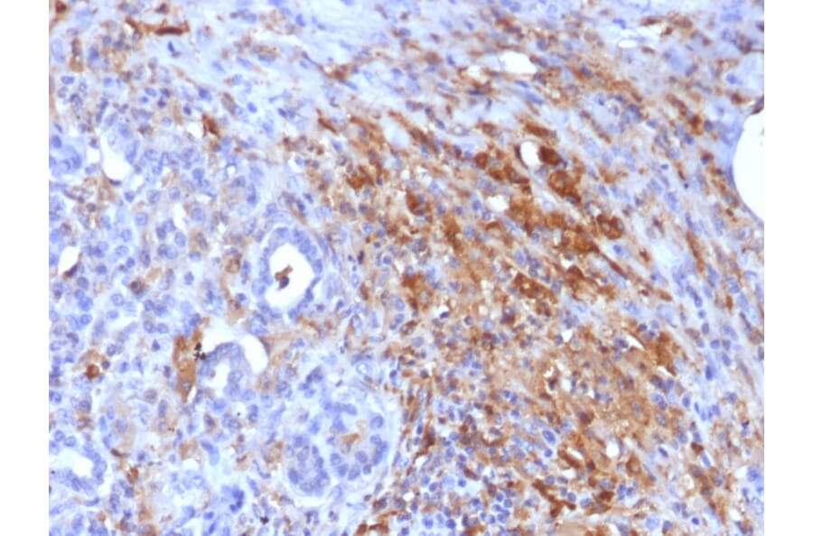 Immunohistochemistry - Anti-Ferritin Light Chain Antibody [FTL/1386] - BSA and Azide free (A251828) - Antibodies.com