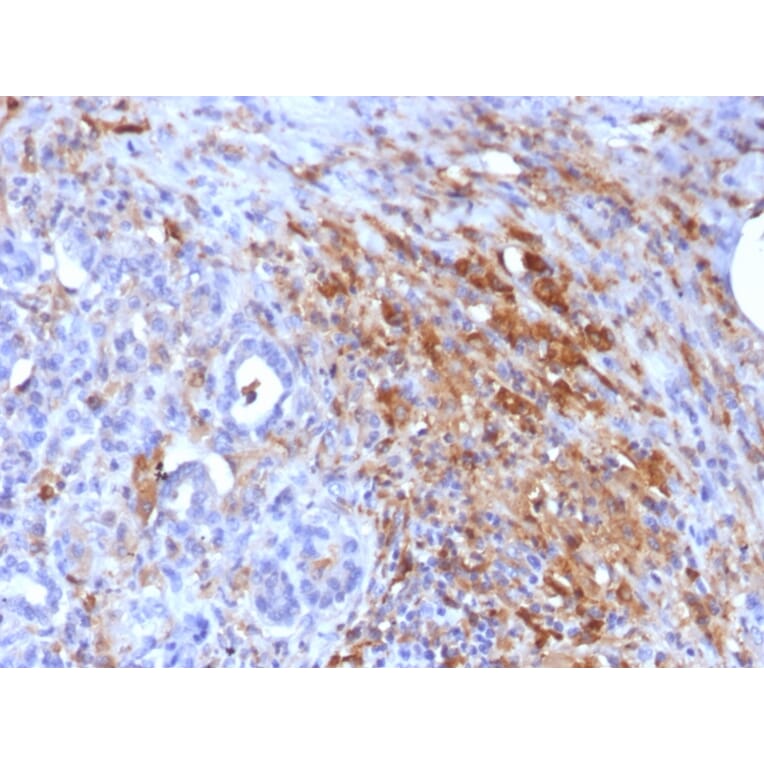 Immunohistochemistry - Anti-Ferritin Light Chain Antibody [FTL/1386] - BSA and Azide free (A251828) - Antibodies.com
