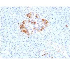 Immunohistochemistry - Anti-Ferritin Light Chain Antibody [FTL/1387] - BSA and Azide free (A251829) - Antibodies.com