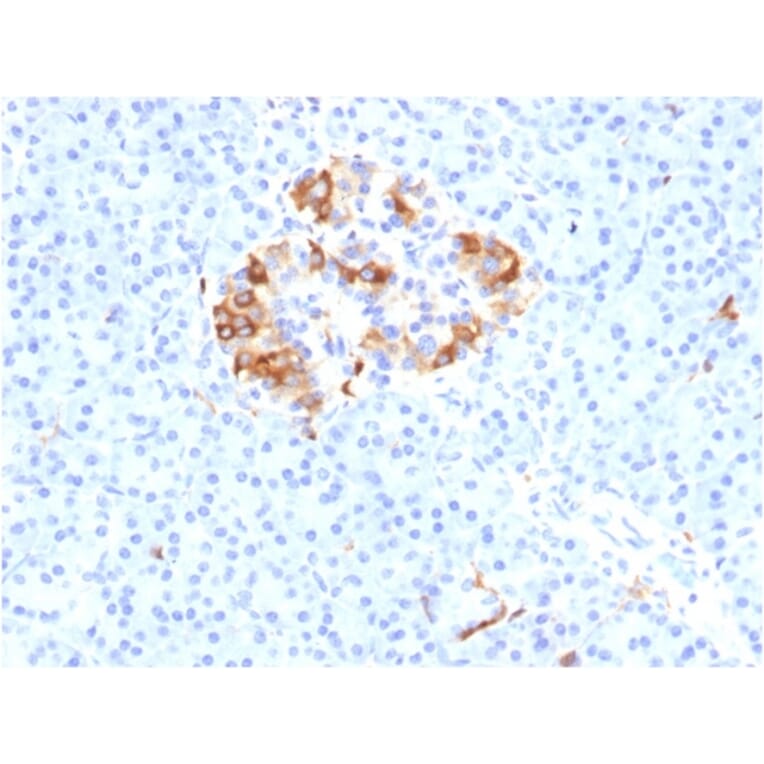 Immunohistochemistry - Anti-Ferritin Light Chain Antibody [FTL/1387] - BSA and Azide free (A251829) - Antibodies.com