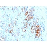 Immunohistochemistry - Anti-Ferritin Light Chain Antibody [FTL/1387] - BSA and Azide free (A251829) - Antibodies.com