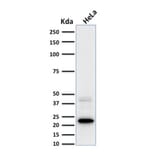 Western Blot - Anti-Ferritin Light Chain Antibody [FTL/1387] - BSA and Azide free (A251829) - Antibodies.com