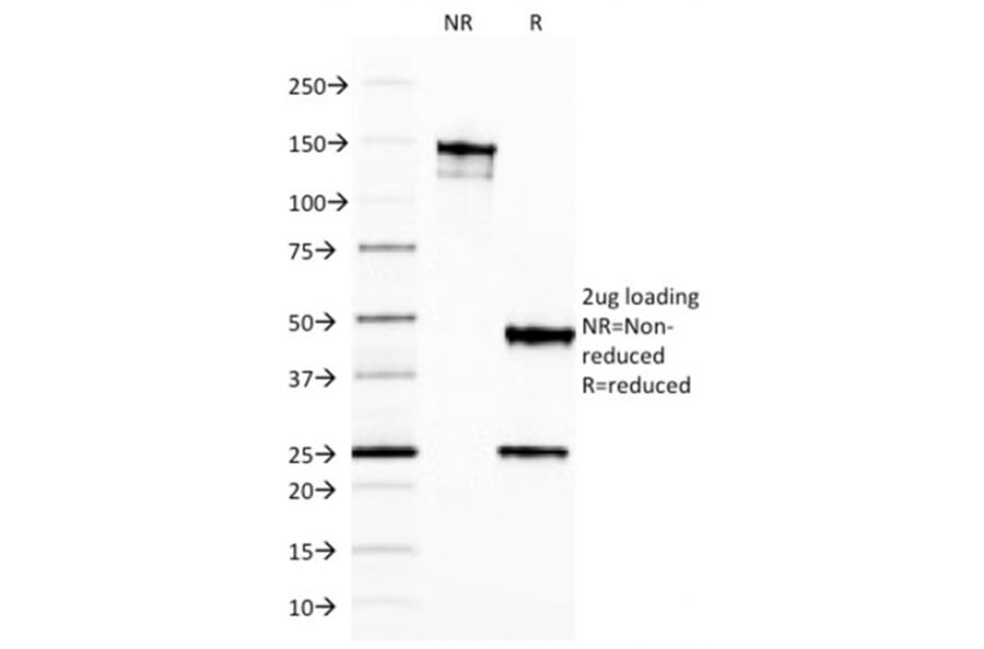 SDS-PAGE - Anti-Ferritin Light Chain Antibody [FTL/1387] - BSA and Azide free (A251829) - Antibodies.com
