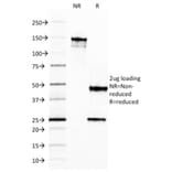 SDS-PAGE - Anti-Ferritin Light Chain Antibody [FTL/1387] - BSA and Azide free (A251829) - Antibodies.com