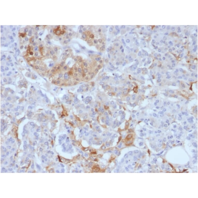 Immunohistochemistry - Anti-Ferritin Light Chain Antibody [FTL/1388] - BSA and Azide free (A251830) - Antibodies.com