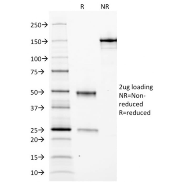 SDS-PAGE - Anti-Ferritin Light Chain Antibody [FTL/1388] - BSA and Azide free (A251830) - Antibodies.com