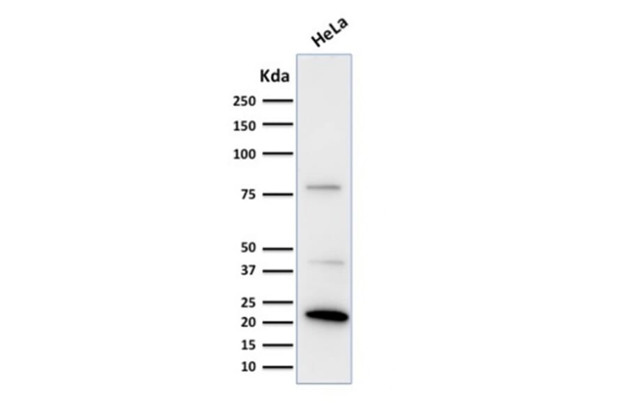 Western Blot - Anti-Ferritin Light Chain Antibody [FTL/1388] - BSA and Azide free (A251830) - Antibodies.com
