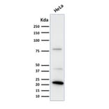 Western Blot - Anti-Ferritin Light Chain Antibody [FTL/1388] - BSA and Azide free (A251830) - Antibodies.com