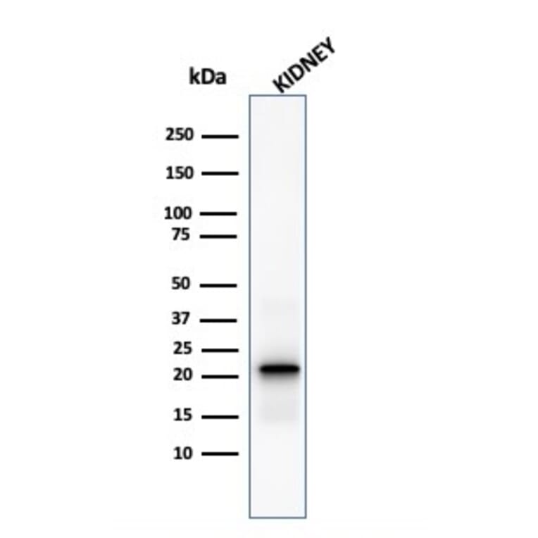 Western Blot - Anti-Ferritin Light Chain Antibody [FTL/1388] - BSA and Azide free (A251830) - Antibodies.com