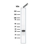 Western Blot - Anti-Ferritin Light Chain Antibody [FTL/1388] - BSA and Azide free (A251830) - Antibodies.com
