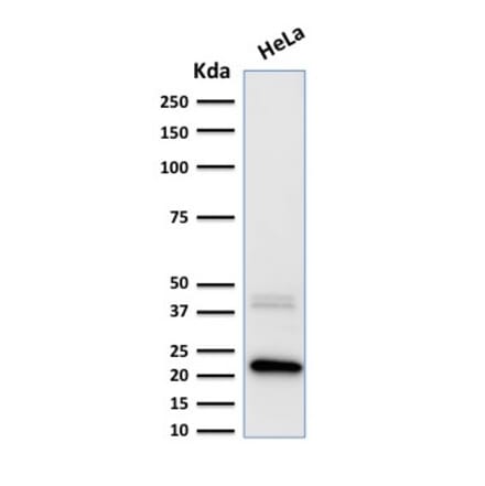 Western Blot - Anti-Ferritin Light Chain Antibody [FTL/1389] - BSA and Azide free (A251831) - Antibodies.com