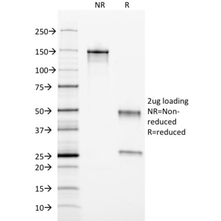 SDS-PAGE - Anti-Ferritin Light Chain Antibody [FTL/1389] - BSA and Azide free (A251831) - Antibodies.com