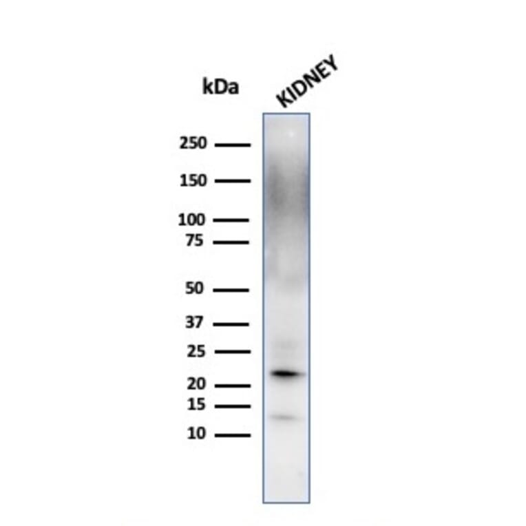 Western Blot - Anti-Ferritin Light Chain Antibody [FTL/1389] - BSA and Azide free (A251831) - Antibodies.com