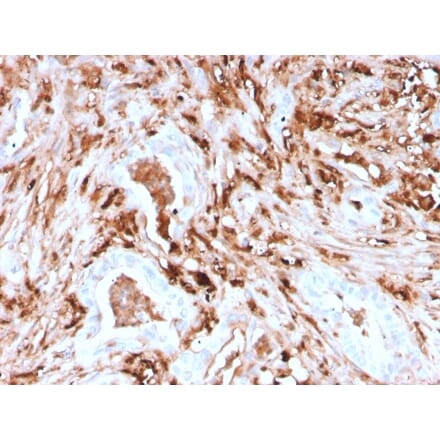 Immunohistochemistry - Anti-Ferritin Light Chain Antibody [rFTL/1388] - BSA and Azide free (A251833) - Antibodies.com