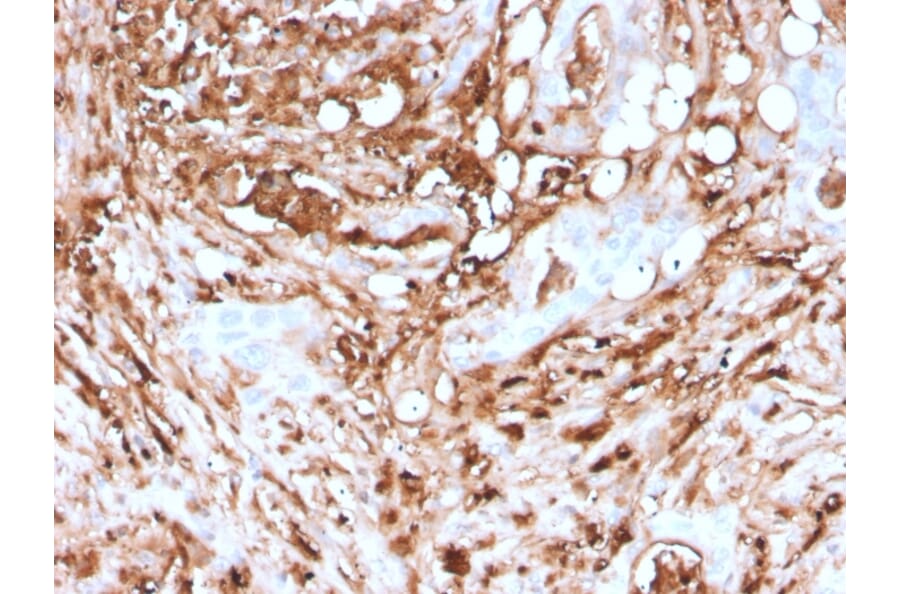 Immunohistochemistry - Anti-Ferritin Light Chain Antibody [rFTL/1388] - BSA and Azide free (A251832) - Antibodies.com
