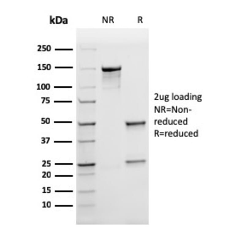 SDS-PAGE - Anti-Ferritin Light Chain Antibody [rFTL/1388] - BSA and Azide free (A251833) - Antibodies.com