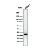 Western Blot - Anti-Ferritin Light Chain Antibody [rFTL/1388] - BSA and Azide free (A251833) - Antibodies.com