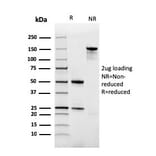 SDS-PAGE - Anti-Ferritin Light Chain Antibody [rFTL/1386] - BSA and Azide free (A251834) - Antibodies.com