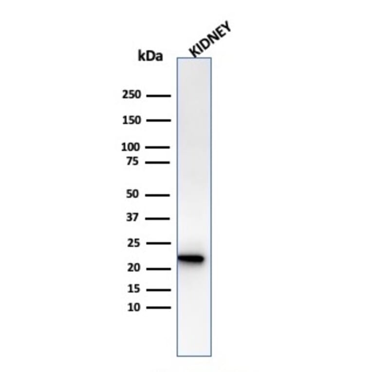 Western Blot - Anti-Ferritin Light Chain Antibody [rFTL/1386] - BSA and Azide free (A251834) - Antibodies.com