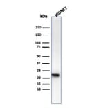 Western Blot - Anti-Ferritin Light Chain Antibody [rFTL/1386] - BSA and Azide free (A251834) - Antibodies.com