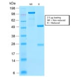 SDS-PAGE - Anti-Ferritin Light Chain Antibody [FTL/2338R] - BSA and Azide free (A251835) - Antibodies.com