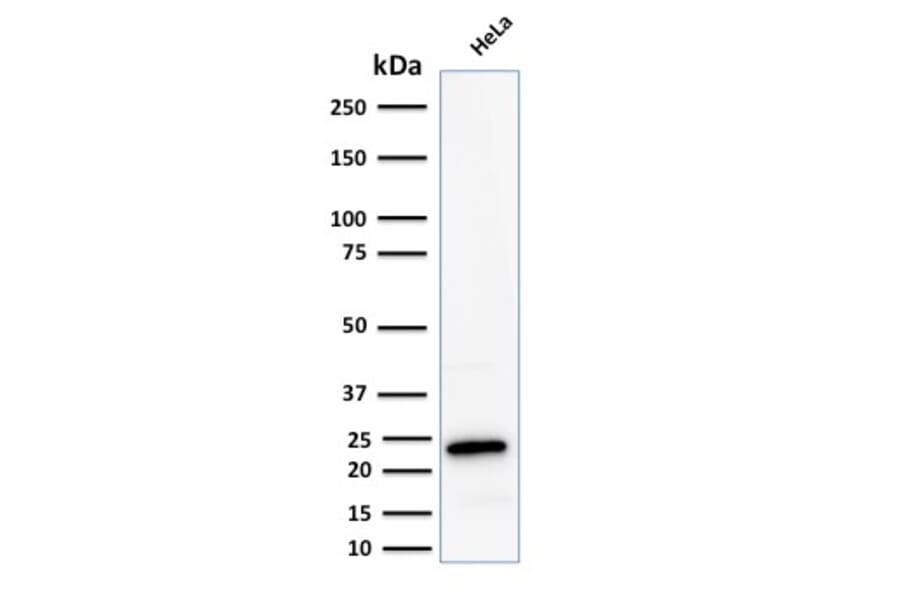 Western Blot - Anti-Ferritin Light Chain Antibody [FTL/2338R] - BSA and Azide free (A251835) - Antibodies.com