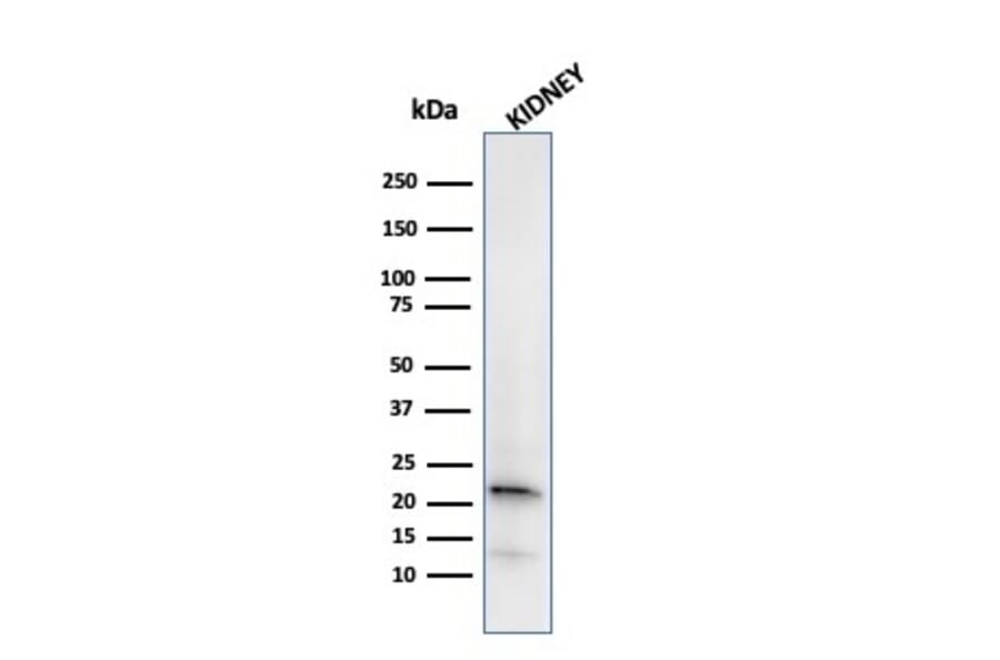 Western Blot - Anti-Ferritin Light Chain Antibody [FTL/2338R] - BSA and Azide free (A251835) - Antibodies.com