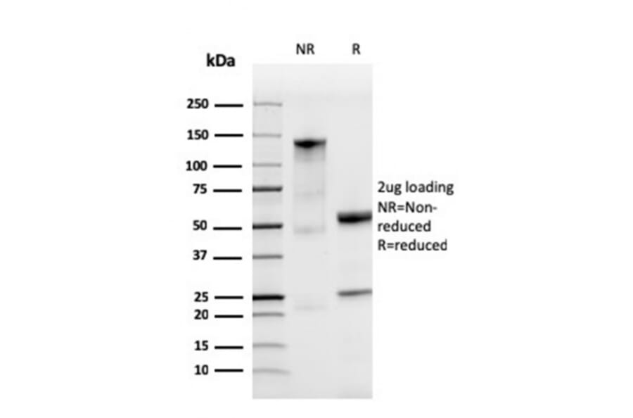 SDS-PAGE - Anti-Ferritin Light Chain Antibody [FTL/3872R] - BSA and Azide free (A251836) - Antibodies.com