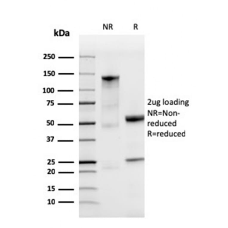 SDS-PAGE - Anti-Ferritin Light Chain Antibody [FTL/3872R] - BSA and Azide free (A251836) - Antibodies.com