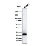 Western Blot - Anti-Ferritin Light Chain Antibody [FTL/3872R] - BSA and Azide free (A251836) - Antibodies.com