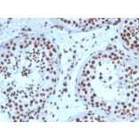 Immunohistochemistry - Anti-Steroidogenic Factor 1 Antibody [NR5A1/3397] - BSA and Azide free (A251837) - Antibodies.com
