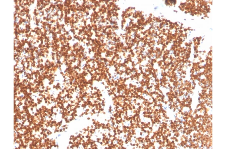 Immunohistochemistry - Anti-Steroidogenic Factor 1 Antibody [NR5A1/3397] - BSA and Azide free (A251837) - Antibodies.com